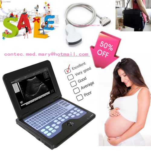 B-ultrasound machine,smart laptop ultrasound scaner+3.5mhz convex probe,cms600p2 for sale