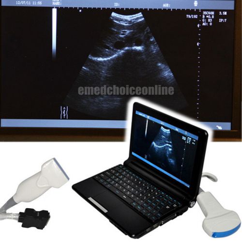 10.1&#039; digital laptop ultrasound scanner convex &amp; linear 2 probes + 3d free ship for sale