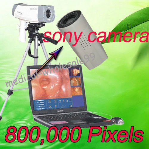 2015 New Digital Electronic colposcope SONY 800,000 pix + Software Key + Tripod