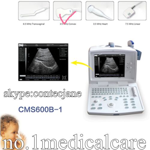 CONTEC Digital Portable B Ultrasound Scanner CMS600B1,Optional 3D Image