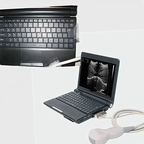Full Digital Portable Notebook Laptop Ultrasound Scanner System Crazy SALE Best