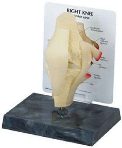 NEW Anatomical Basic Knee Joint Model WOW!