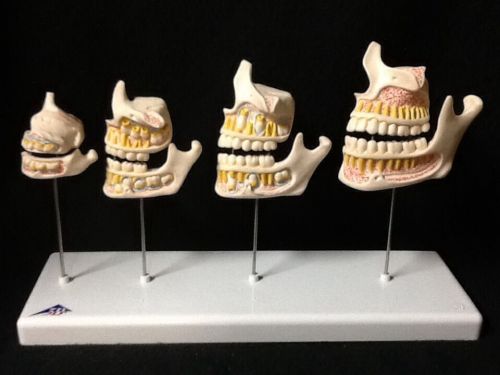 3b scientific - d20 dentition development jaw, teeth set anatomical model (d 20) for sale