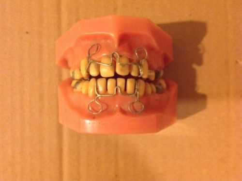 Orthodontic Dental Teeth