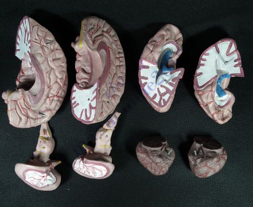 RS Medical Anatomical Human Brain Model Life Size DISPLAY TEACHING DEMONSTRATE