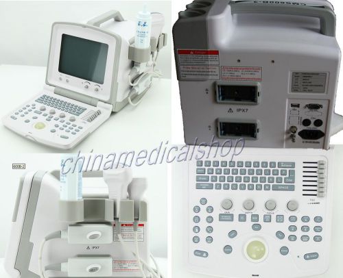 2014 Portable Digital Ultrasound Scanner Machine with tow probes convex &amp; linear