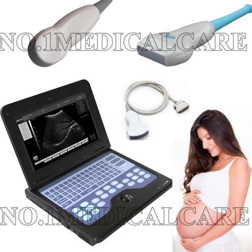 Laptop b-ultrasound scanner cms600p2, 3 probe 3.5 convex/micro convex/7.5 linear for sale