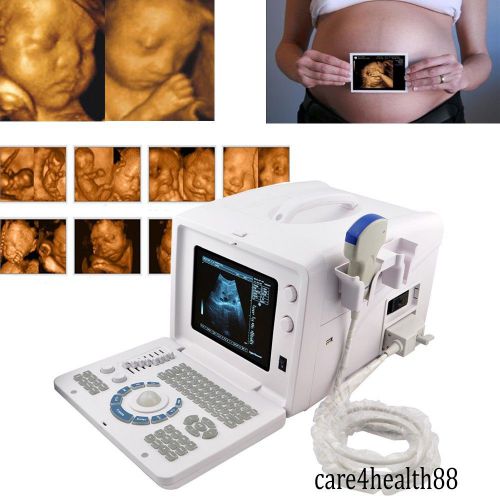 Portable full-digital ultrasound machine scanner system 3.5mhz convex extrnal 3d for sale