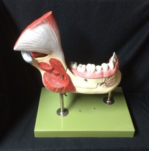 SOMSO ES21 Right Lower Jaw w/ Muscles &amp; Teeth Anatomical Model, 14 parts (ES 21)