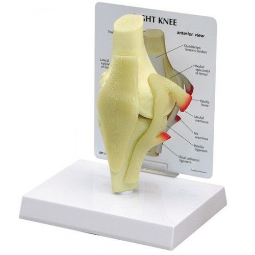 NEW Anatomical Basic Knee Joint Model WOW! OVERSTOCKED RETURNED BY CUSTOMER