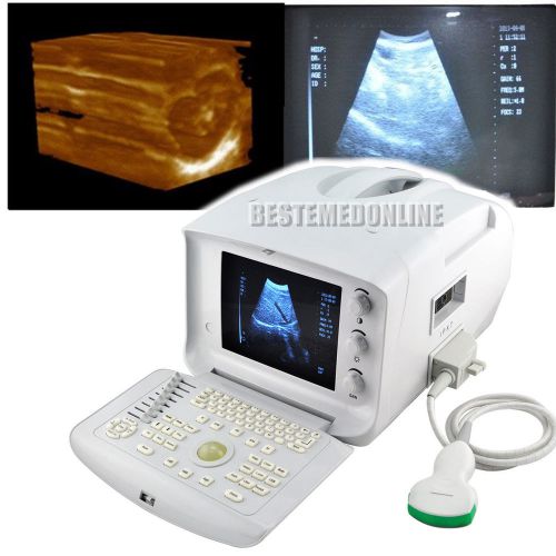 Portable digital Ultrasound Scanner w CONVEX probe USB PORT 3D image software