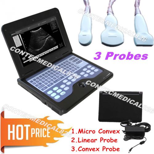 Notebook digital ultrasound  scanner with 3 probes  (convex+linear+micro convex) for sale