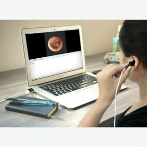 Teslong Camera Endoscope Otoscope Digital Video Ear Scope Inspection 6LED Lights