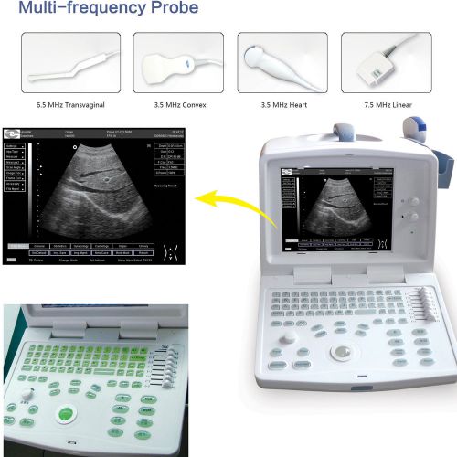 CMS600B-1 Full Digital CE Portable Ultrasound Scanner with 3.5MHZ Convex probe