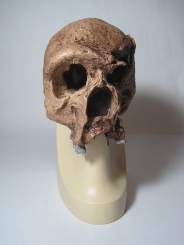 3b scientific 7.5&#034; x 4.9&#034; steinheim anthropological skull model vp7531 usg for sale