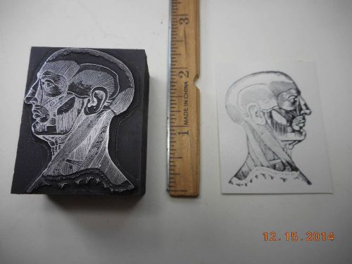 Letterpress Printing Printers Block, Medical Anatomy, Muscles of the Head &amp; Neck