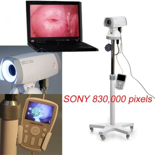 Electronic colposcope sony camera 830,000 pixels rcs-500 high image for sale
