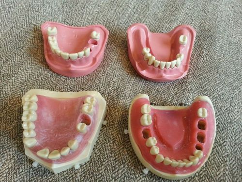Assorted Lot: Columbia Dentoforms with extra ivorine teeth