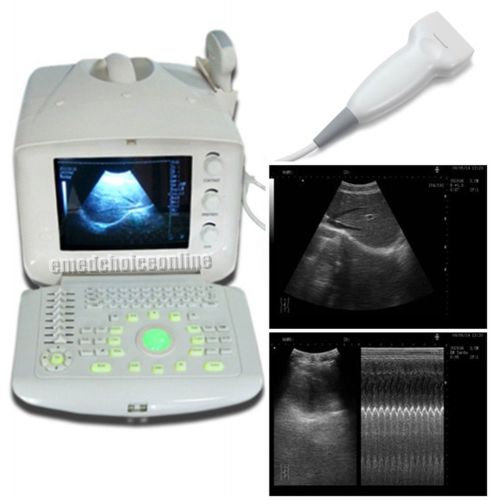 Portable Ultrasound Scanner Sysytem Machine +7.5MHZ Linear probe+WARRANTY