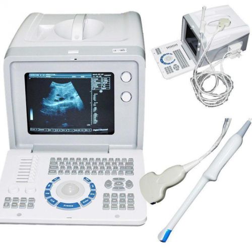 3D Digital Portable Ultrasound Scanner Machine convex +Transvaginal Probe useful