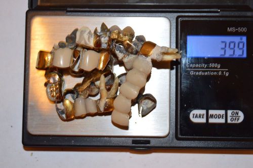 dental scrap 39.9 grams