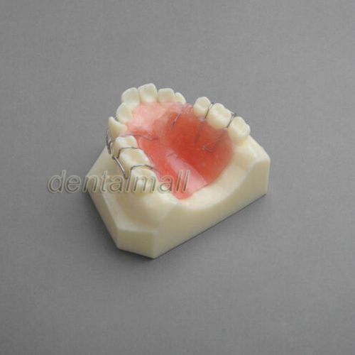 Dentalmall Dental Model #3007 01 - Hawley Retainer Model