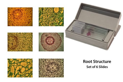 Microscopy Prepared Slides: Root Structure - Set of 6