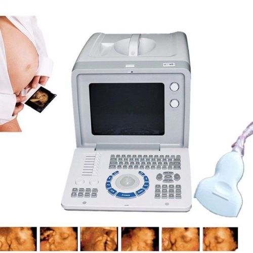 2015 portable digital 10-inch ultrasound scanner with convex probe rus-6000d for sale