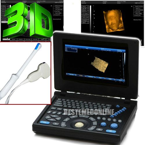 Fda new pc platform full digital laptop ultrasound scanner convex + tv 2 probes for sale