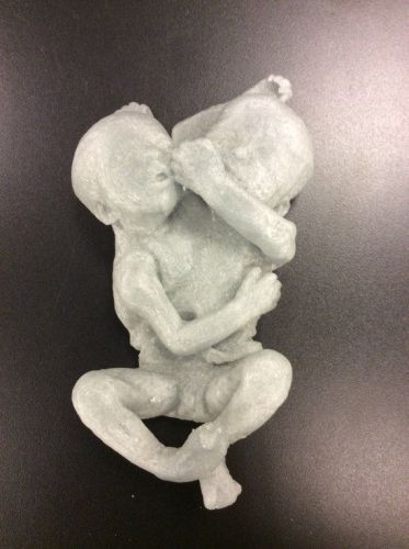 Real human fetal baby infant rare conjoined-twin reproduction anatomical model