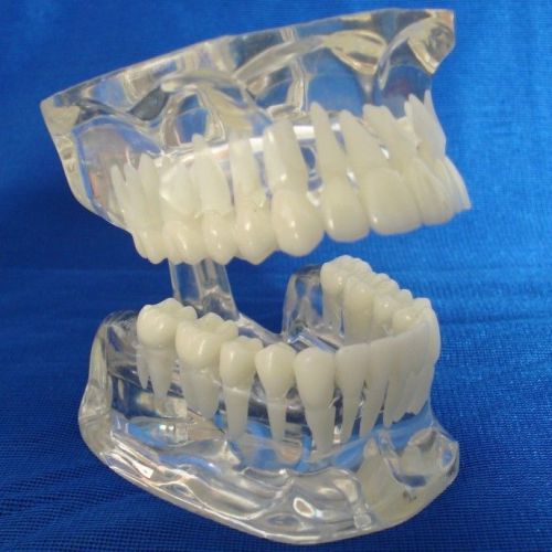 Transparent oral the model standards dentition epoxy