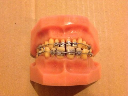 Orthodontic Dental Teeth With Braces