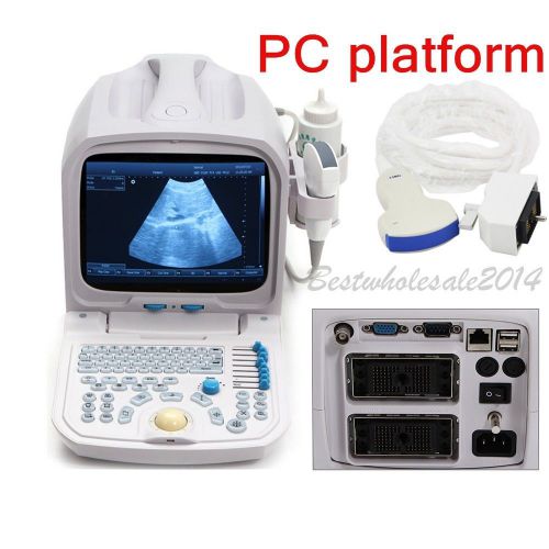 3D PC Plateform, 10.4&#039;&#039; Full Digital Portable Ultrasound Scanner, Convex Probe s