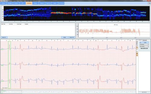 HeartFX 2014 ECG Holter Analysis Software for Windows