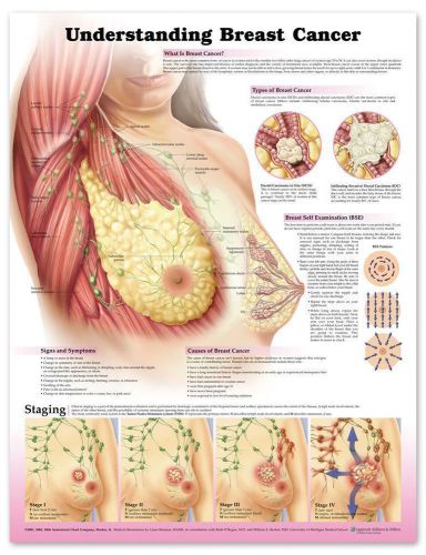 UNDERSTANDING BREAST CANCER, LAMINATED ANATOMICAL CHART, 20 X 26