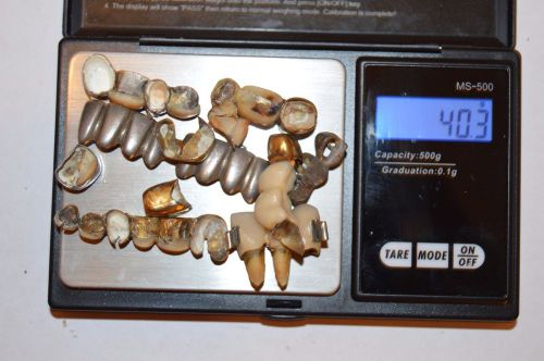 dental scrap 40.3 grams