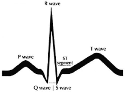 EKG Study Guide and Understanding an EKG &amp; Rhythms on 2 DVDS