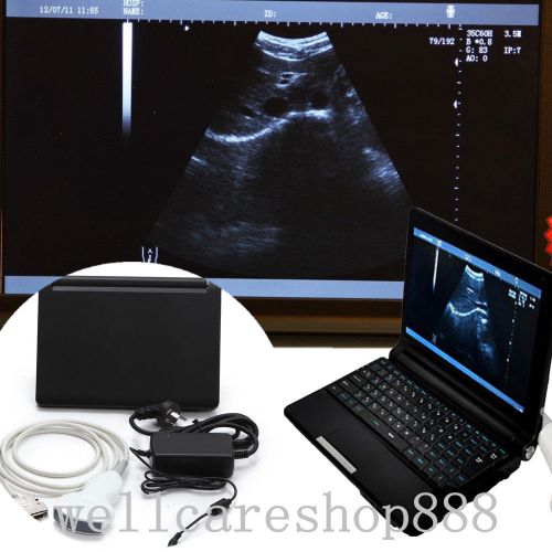 2014 new breed season full digital ultrasound scanner machine + 3d + warranty for sale