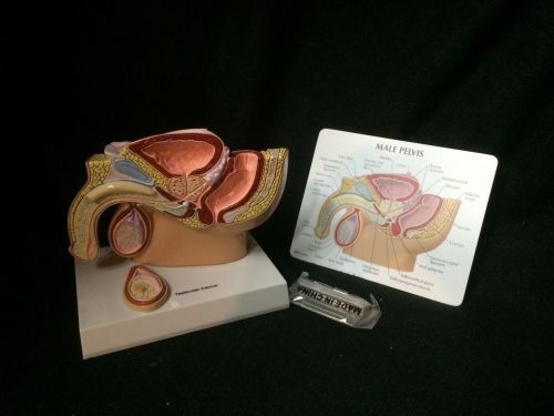 GPI #3570 Male Pelvis with Testicles &amp; Testicular Cancer Anatomical Model