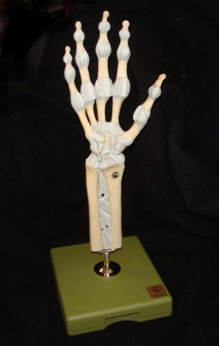 SOMSO NS 21/1 Joints of Hand and Fingers with Ligaments Anatomical Model