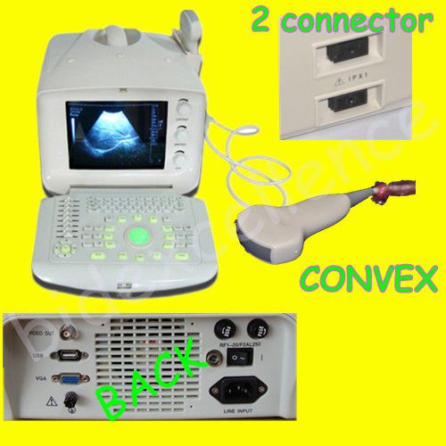 CE Portable Digital Ultrasound Scanner/Machine + Convex Probe 2 USB port + 3D SF
