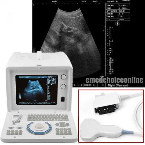 NEW Full Digital Portable Ultrasound Scanner B ultrasonic Machine + Convex + 3D