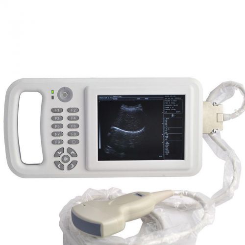 6.5 inch LCD Handheld Full Digital Laptop Ultrasound Scanner with Convex Probe