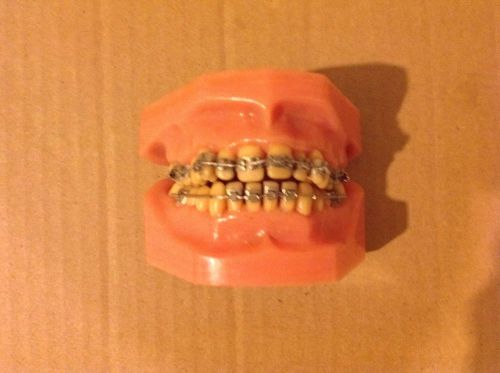 Orthodontic Dental Teeth With Braces #3