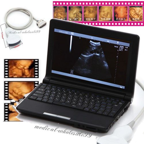 New Laptop Ultrasound Scanner / Machine + 3.5MHz Abdomen Convex Probe +3D SW