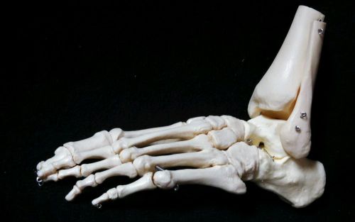 3B Scientific - A31/1L Loose Left Foot &amp; Ankle Skeleton Bone Anatomical Model