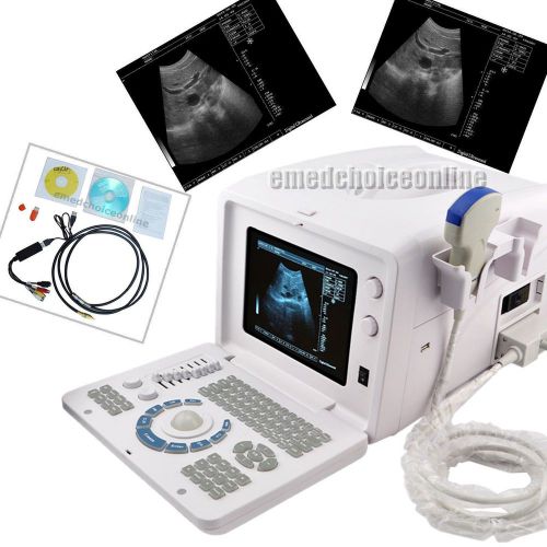 Ce+3d portable digital ultrasound machine scanner system +3.5 mhz convex probe-1 for sale