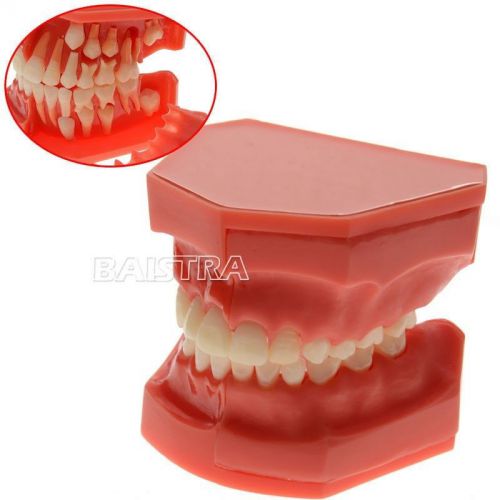 HOT 1 PC Dental Teeth Permanent Alternate Demonstration Study Teach Model 4006