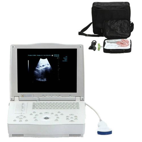 15&#039;&#039; monitor digital laptop ultrasound scanner/machine + 3.5mhz convex probe 3d for sale