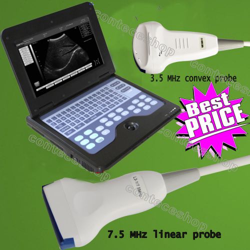 Promotion! digital laptop ultrasound scanner+7.5Mhz Linear probe+3.5mhz Convex